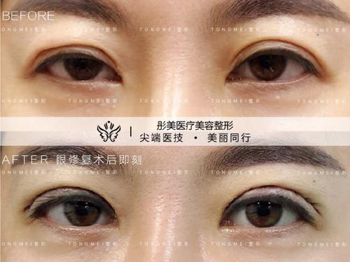 中国的眼部修复最好的专家是哪个