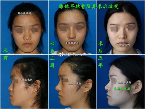 2022年上海最出名的隆鼻&鼻修复专家有哪些？