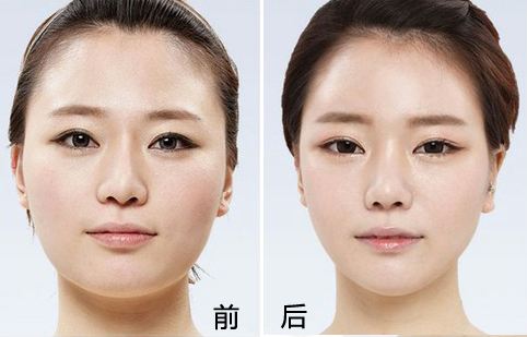 上海九院改脸型专家哪个最厉害？