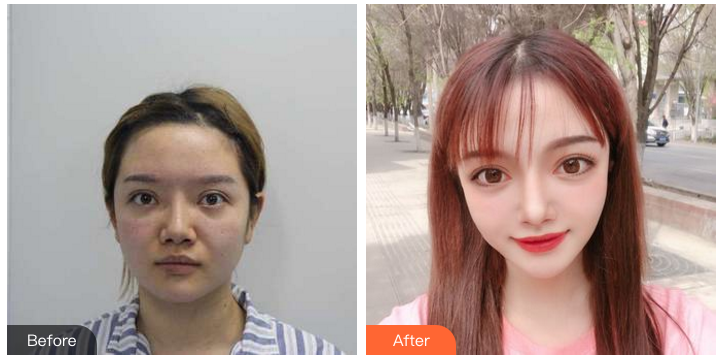 广州鼻修复哪个医生好？