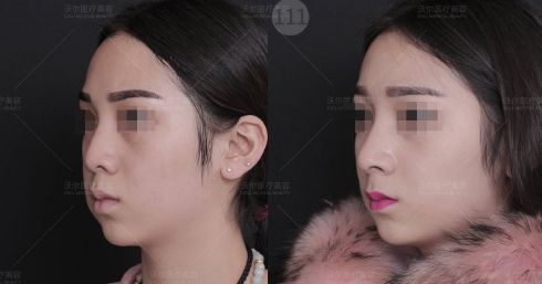 全国最好的鼻修复专家是谁