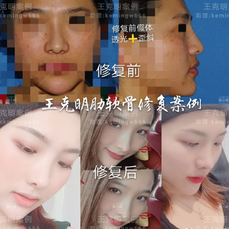 北京八大处最好的隆鼻医生是谁