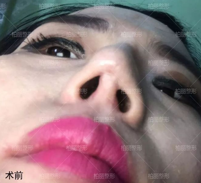 国内高难度鼻修复专家有哪些？收费多少？