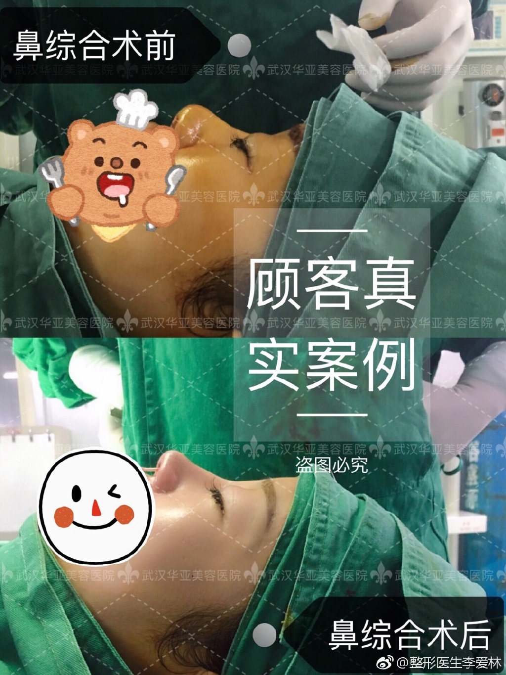 李爱林鼻综合效果好不好？有做失败的吗？
