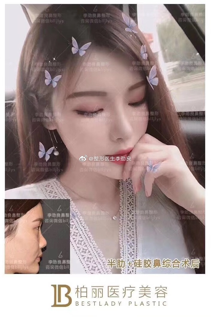 2020年中国鼻综合整形最好的专家预约