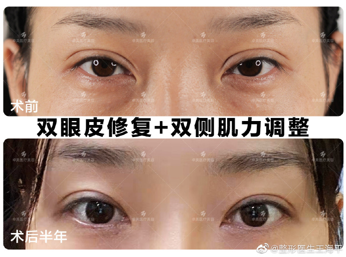 武汉修复眼部的十大专家都有谁