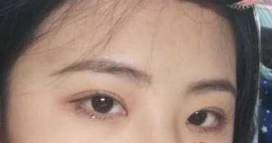上海哪个专家做双眼皮好
