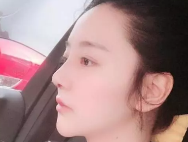 深圳修复鼻子比较有名的医生是谁