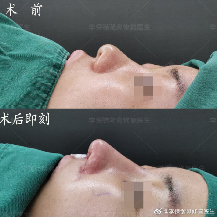 杭州隆鼻专家前十名都有谁