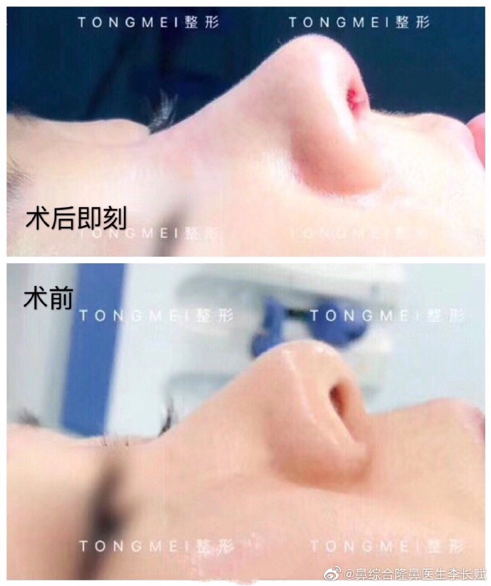 北京做鼻子好的医生有哪些呢？
