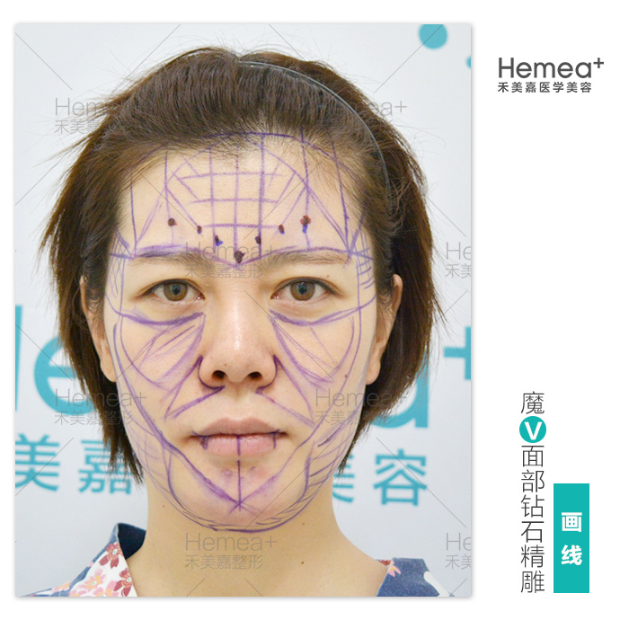 北京任学会和王明利谁脂肪填充好