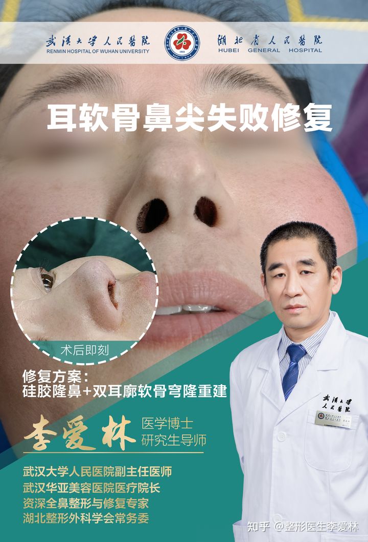 武汉做隆鼻李爱林和叶子荣哪个好？