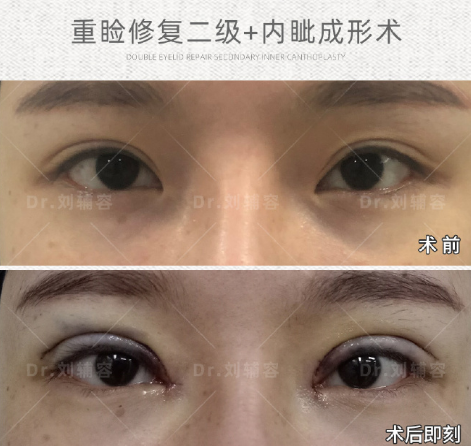 白永辉和刘辅容哪个修复好