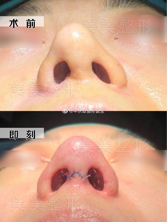 郑州有哪些做歪鼻比较好的医生