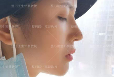 武汉李爱林和邓裴谁做鼻子好