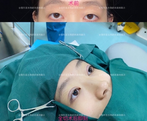 北京眼综合做的好的医生是哪个