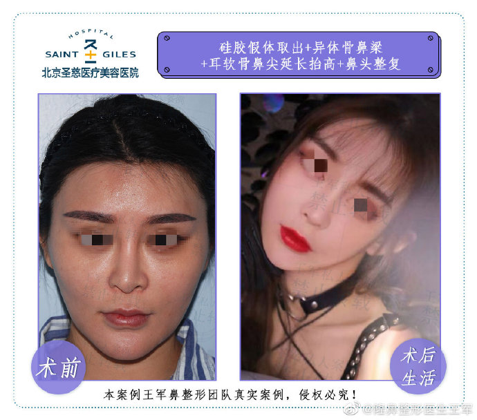 中国有名的鼻整形医生