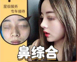 武汉鼻综合做的最好的医生