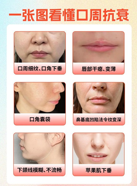 济南丽合微整院长刘近彬：拯救口周衰老从现在做起