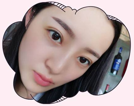 南京眼综合哪个医生做的好