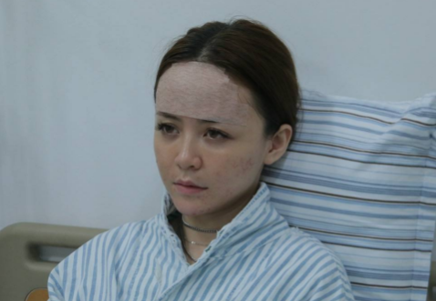 上海自体脂肪填充专家有哪些