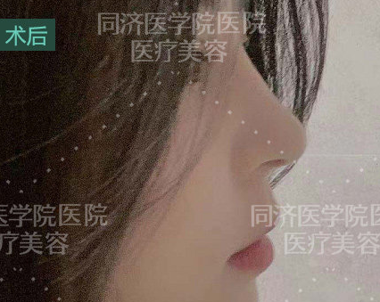 武汉哪个医生做鼻子好