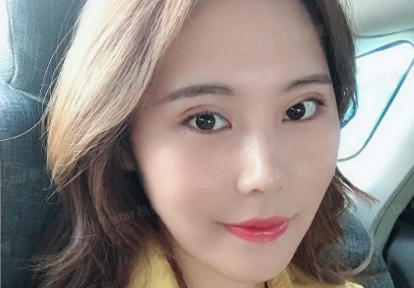 上海做双眼皮最厉害的医生是谁
