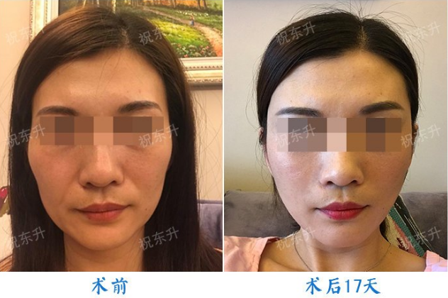 金云波和李青峰哪个做面部年轻化好