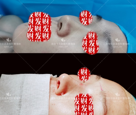 曹海峰和陈明亮哪个做鼻子更好