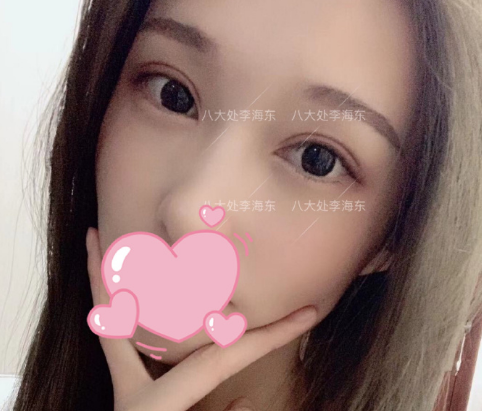 李海东和靳小雷哪个双眼皮做的好？