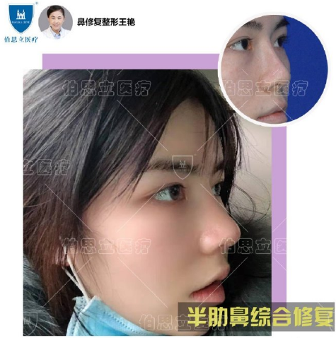 上海鼻部修复哪个医生最好