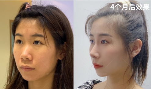 2022年国内最好的隆鼻专家都有哪些？