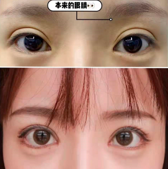 杭州双眼皮修复医生杨连华、徐一波、孟晨曦、陈海华、高寿松、石杭燕哪个最好？
