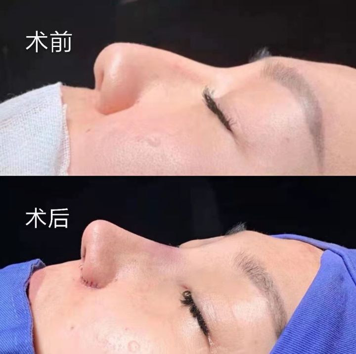 成都隆鼻前十名预约 成都隆鼻谁最好？