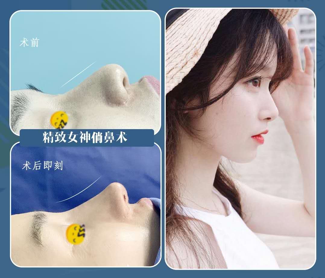 重庆做鼻子最有名的医生是哪个