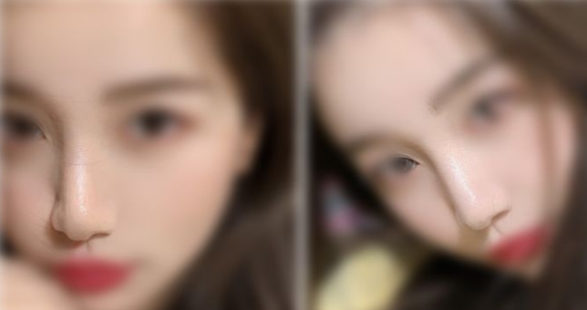 南昌隆鼻专家排行
