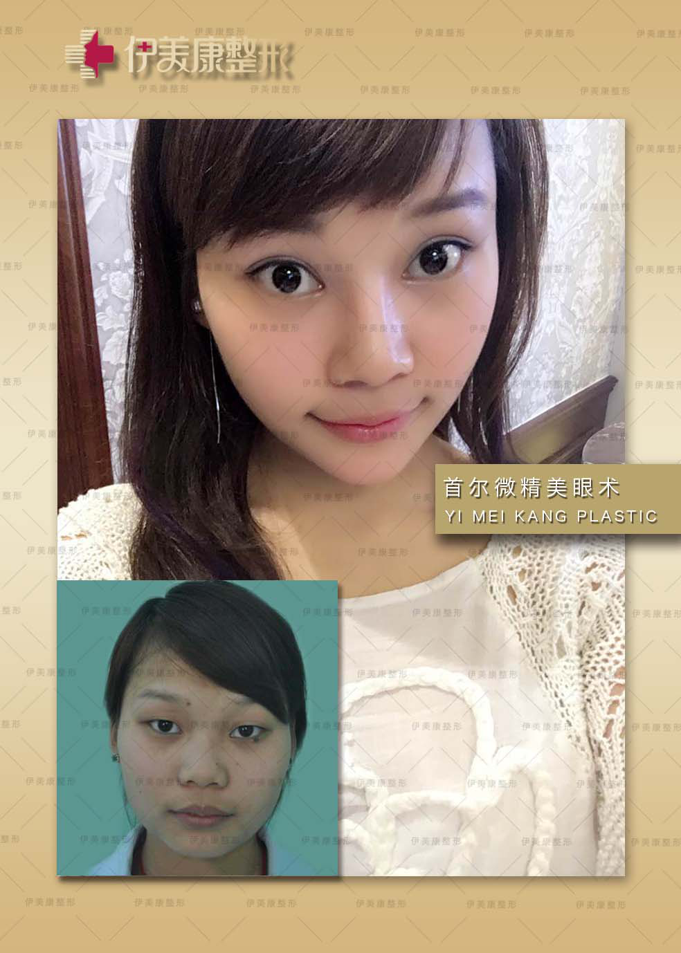 刘莹_郑州伊莱美整形医院整形专家