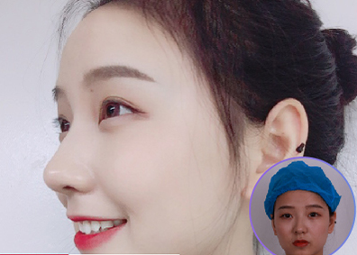 长沙做鼻子有名的医生是哪个