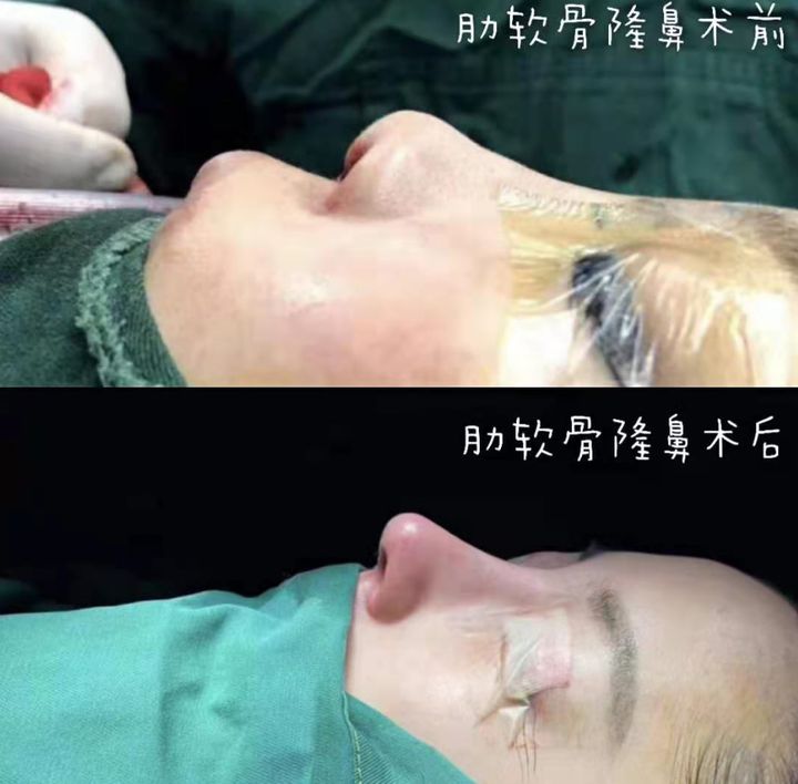 2022年昆明鼻修复最好的医生有哪些？
