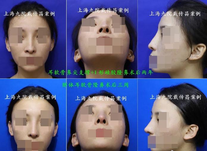 上海九院谁做鼻修复好