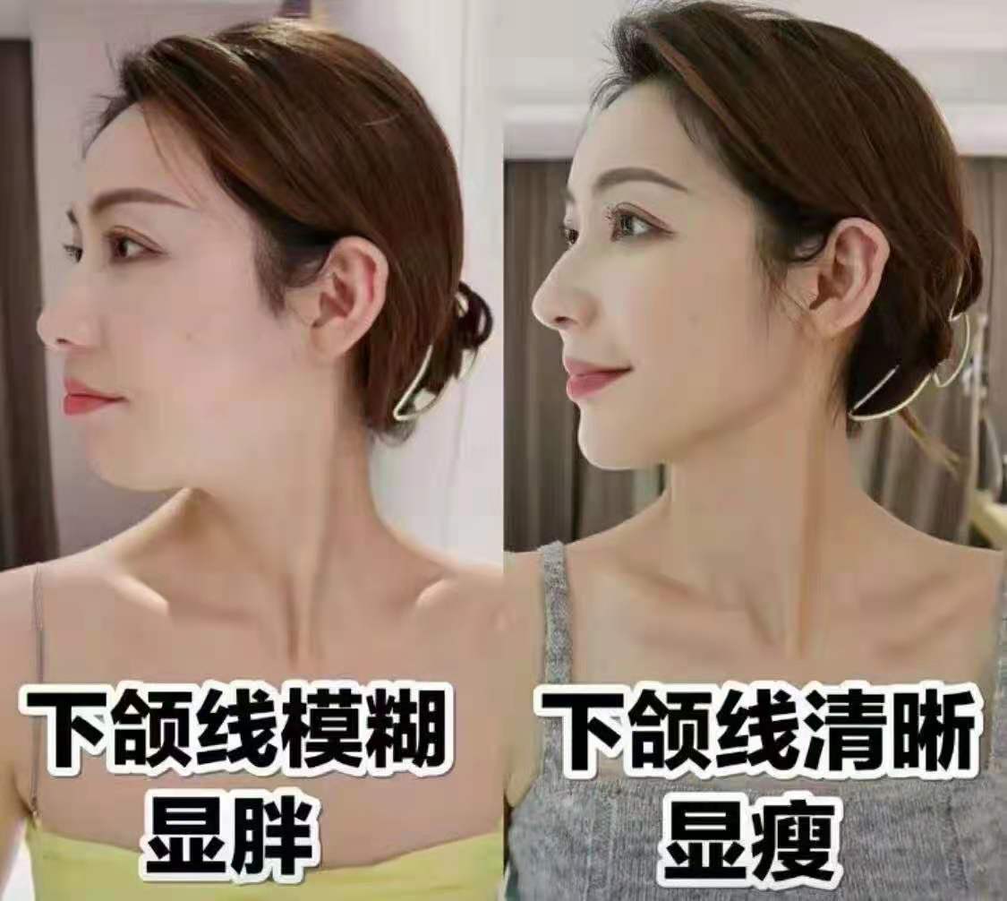 上海九院面部吸脂哪个医生好