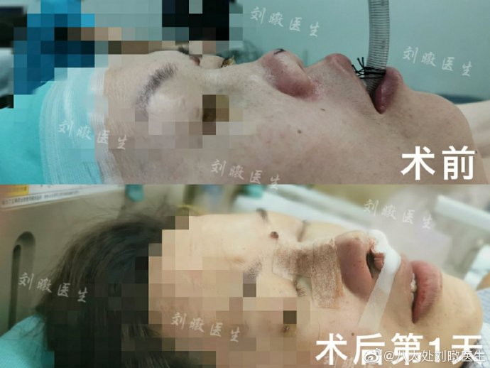 北京八大处刘暾做鼻子技术怎么样？效果好不好看？