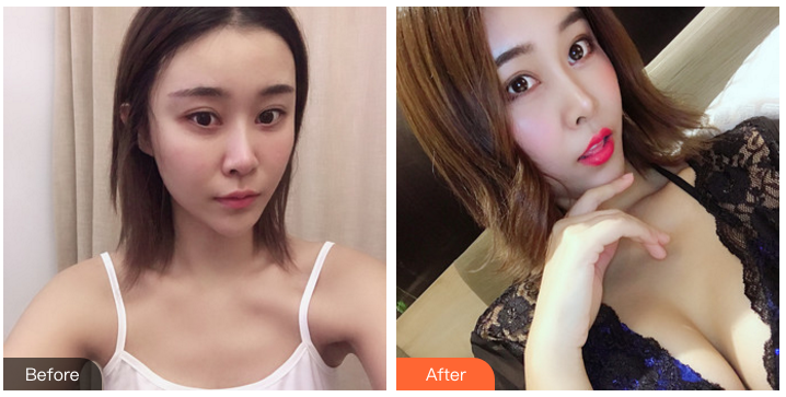 全国十大隆胸专家是谁，哪个最好？