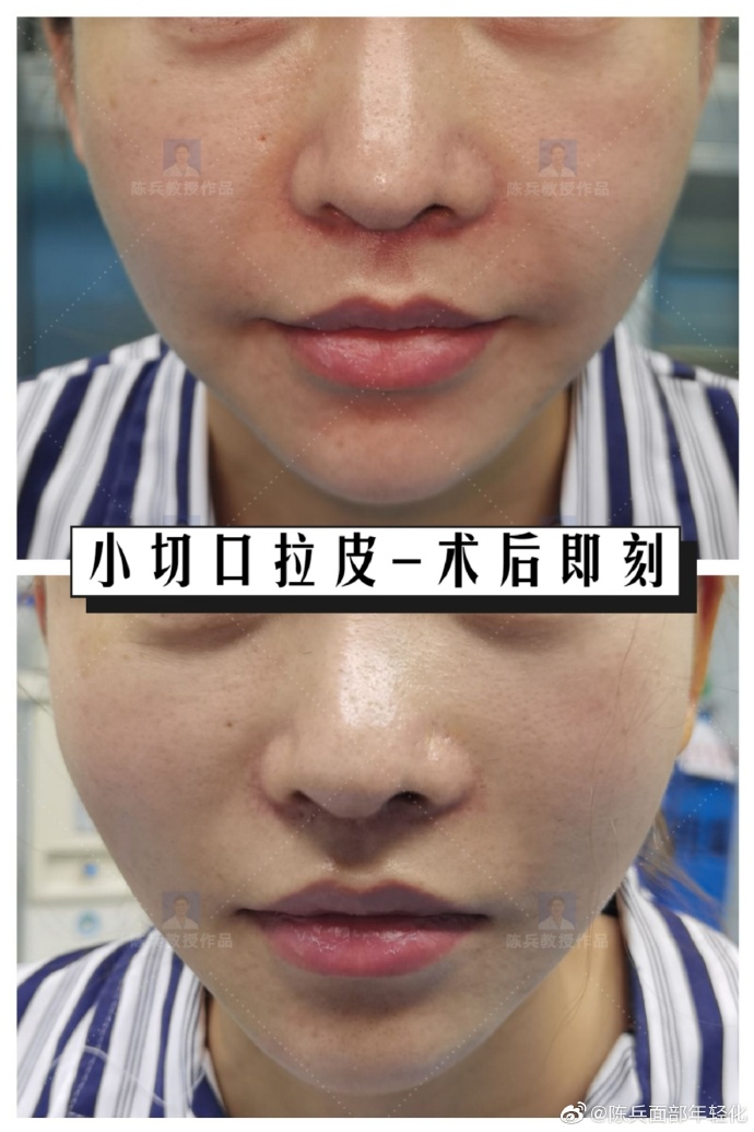 广州陈兵拉皮做得好不好？