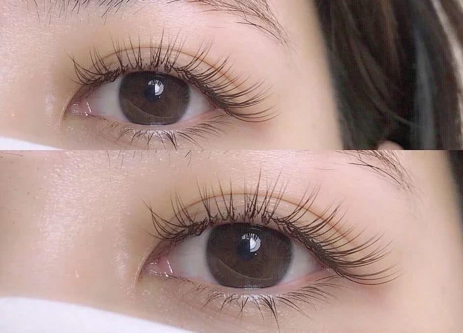 重庆双眼皮做的好的医生