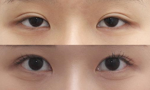 杭州眼修复最好的医生是谁