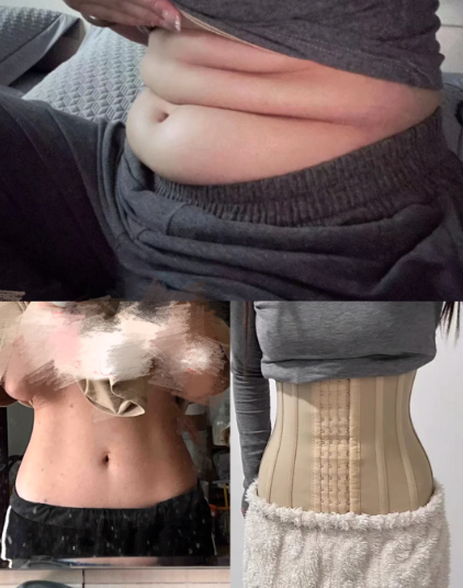 郑州有没有好的吸脂医生推荐？2026年郑州吸脂最好的专家预约排行榜大全