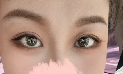 北京八大处马宁、梁雪冰、卢建建、李梓菲、宗宪磊、吴荣薇、宋涛、翟震、宋宇鹏、王淑杰做双眼皮谁好？