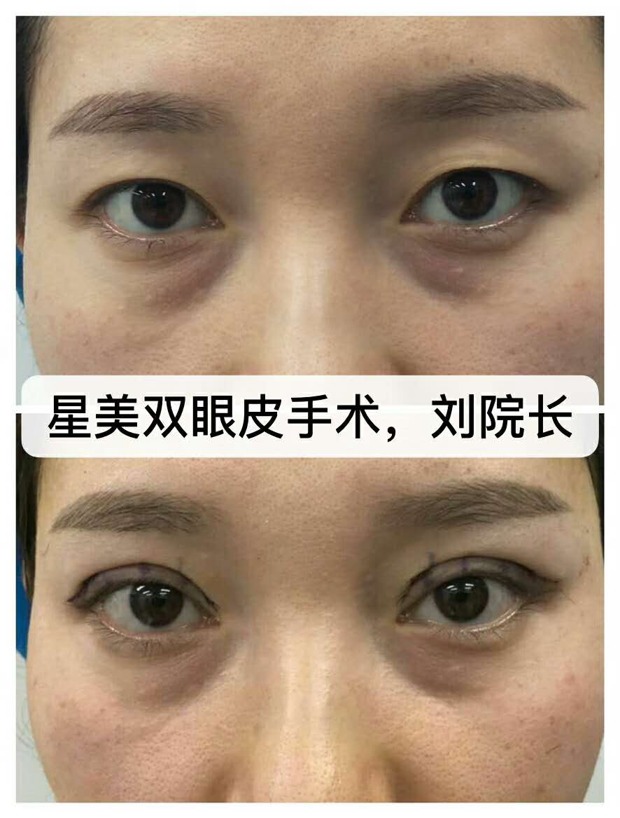 刘勇_北京星美医疗美容技术院长