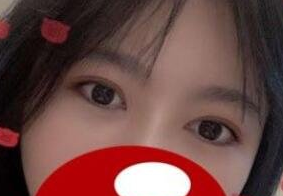 长海医院哪个医生割双眼皮好